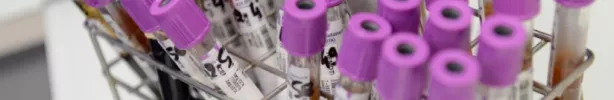 Laboratoire d'hématologie