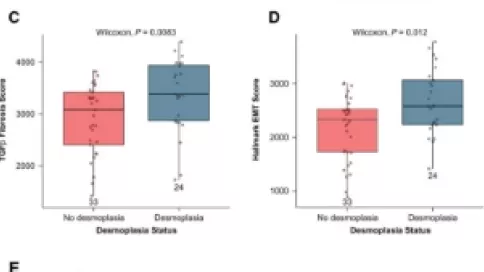 Visuel axe 3 - Associations between hallmark EMT ssGSEA score and TGF-β gene signatures in all archival tumors with gene expression